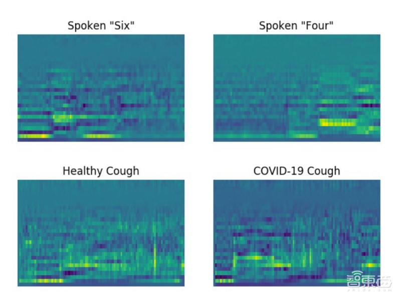 新冠病毒還能用語(yǔ)音識(shí)別？AI模型“聽(tīng)”咳嗽聲判斷是否感染