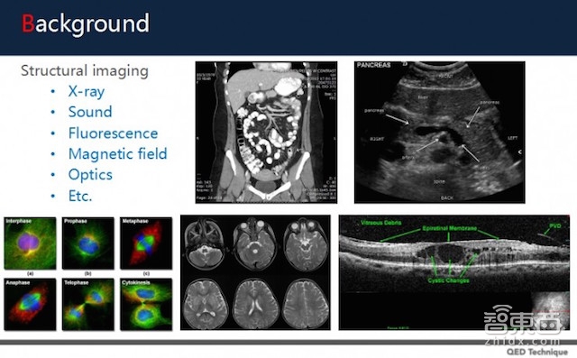 AI看片彻底火了!11家公司融资5亿 腾讯阿里抢着入局
