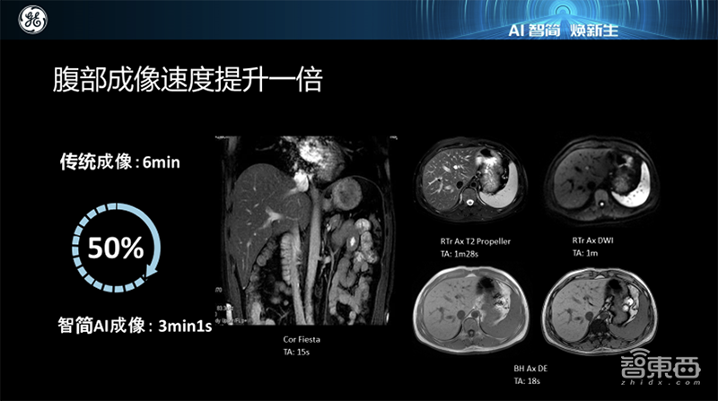 让磁共振成像速度翻倍！GE医疗用10万图像喂出超强AI
