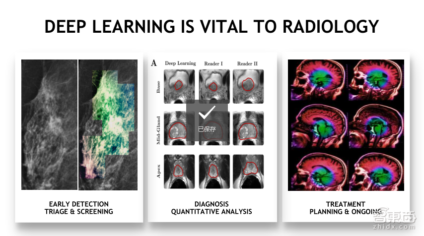 【PPT下载】从基因诊断、药物发现到医疗影像分析,11个案例帮你读懂深度学习在医疗领域的应用