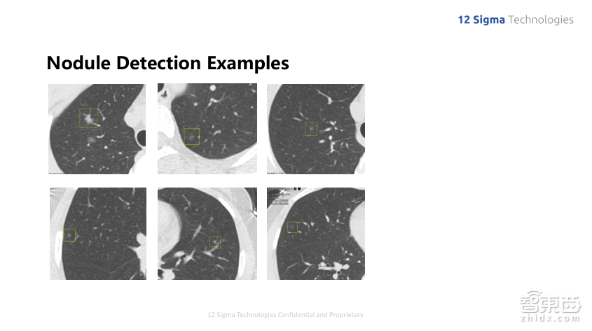 深度学习如何提升肺结节良恶性诊断准确率到90%?图玛深维首席科学家陈韵强给出了答案!