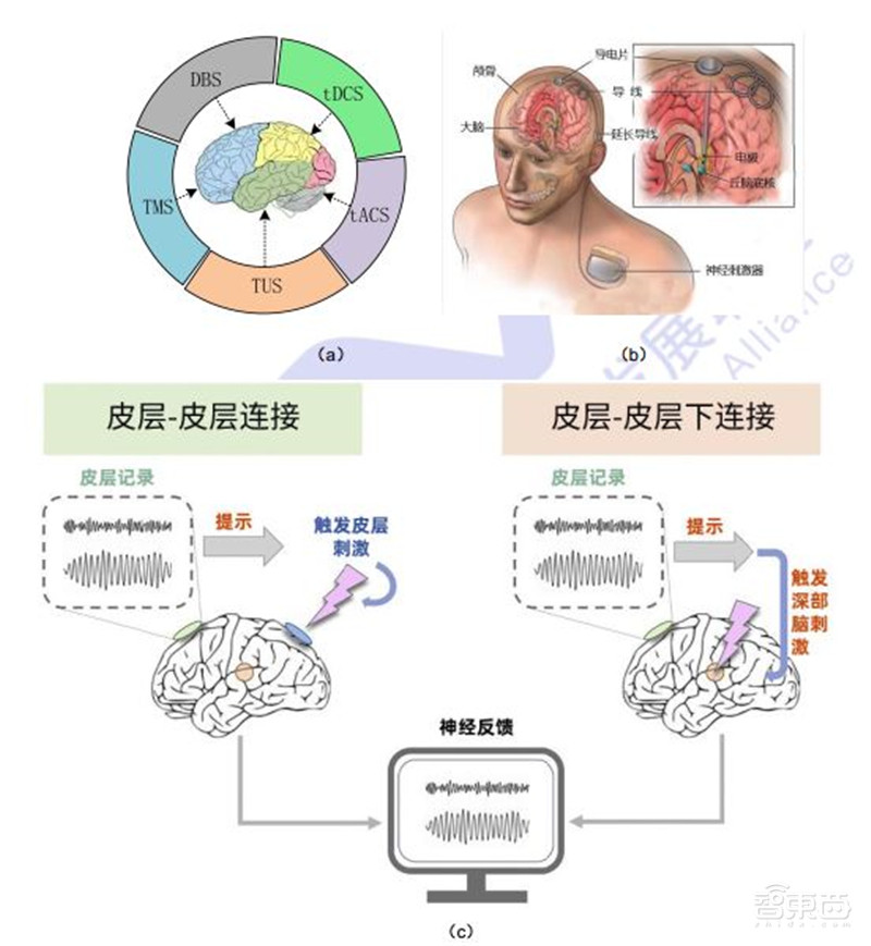 脑机接口破圈医疗！对五种疾病或有奇效，难怪马斯克吹爆 | 智东西内参