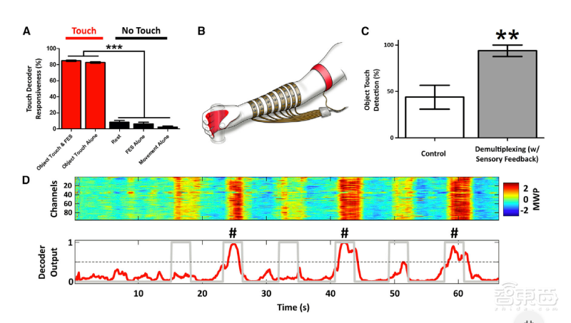 脑机接口解决脊髓损伤：患者能做20种动作，还能打游戏！
