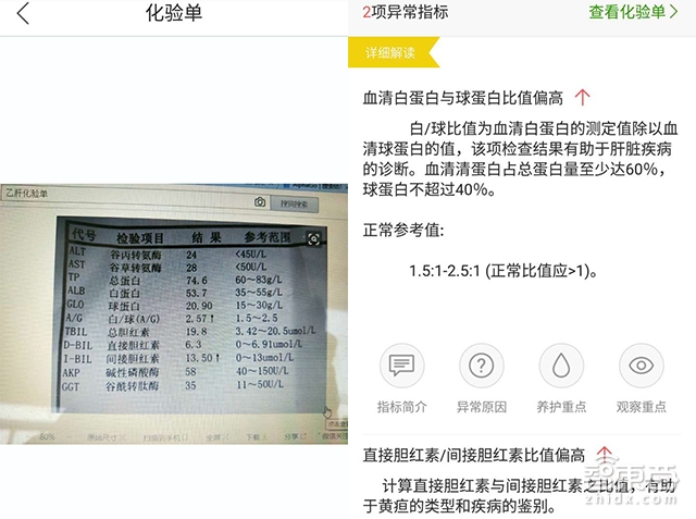 這位清華女學(xué)霸做了件了不起的小事：讓醫(yī)院化驗(yàn)單說人話