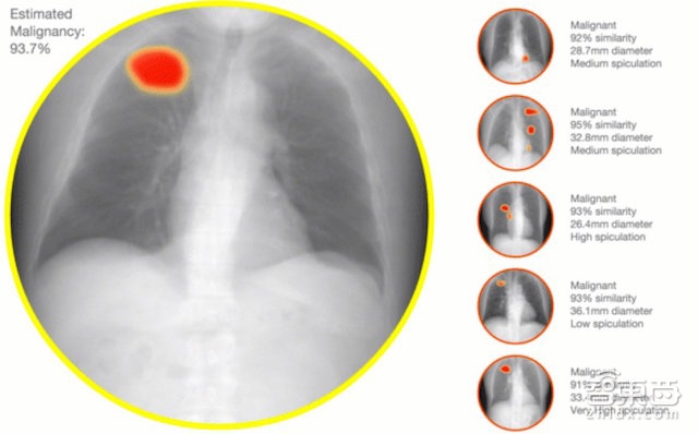 这位清华女学霸做了件了不起的小事：让医院化验单说人话