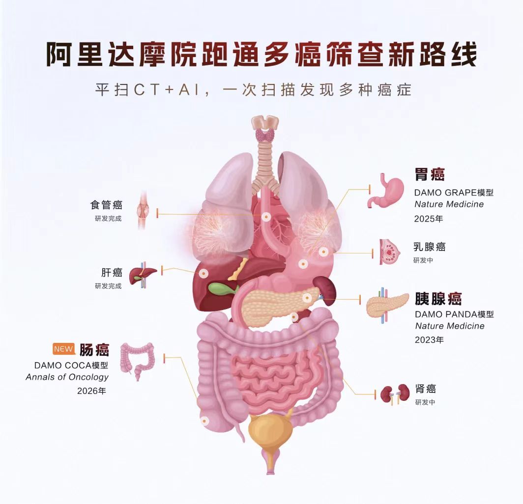 全球首次!达摩院肠癌“无感”检测模型登顶刊,靠平扫CT找出漏诊