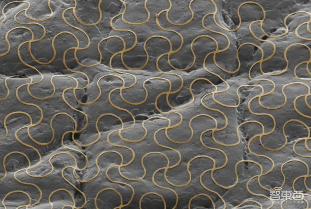 从意念书写到电子皮肤，微型芯片如何打开仿生之门？