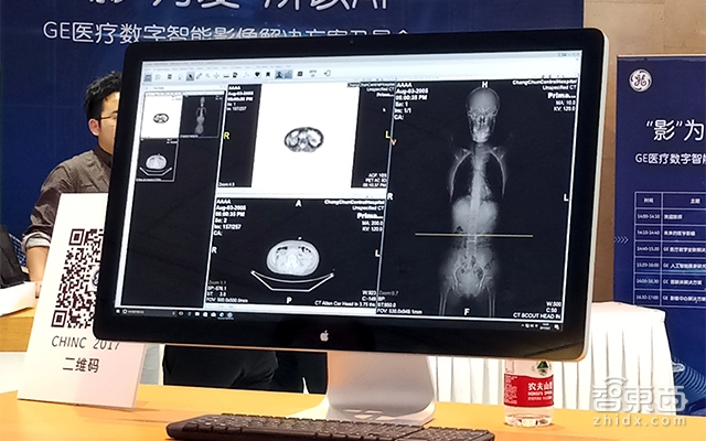 通用电气推出智能医疗影像系统UV6.0 已在3000家机构投入使用