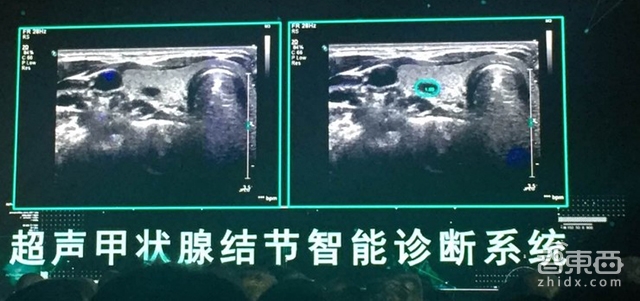 生老病死逃不掉！起底中美6大科技巨头智能医疗布局