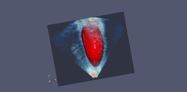 拯救顽疾大作战!IDC绘中国医疗AI生态图谱,英伟达献医疗影像新杀器【附下载】|智东西内参