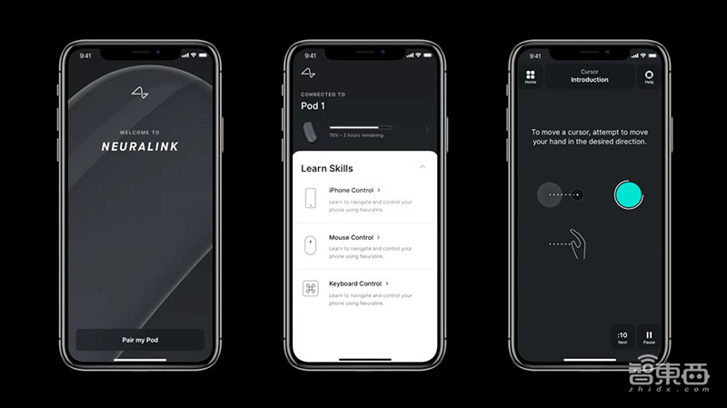 明年开始人体实验!马斯克脑机接口重大突破,已能让猴子用脑控制电脑