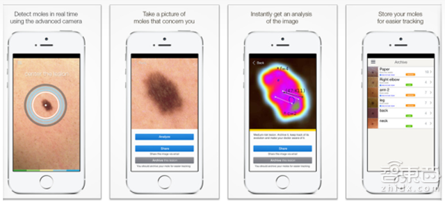 皮肤癌检测应用 SkinVision 获得 340 万美元投资
