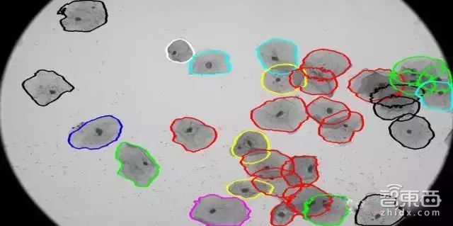 GTIC2018 | 深思考杨志明:专用芯片+算法如何突进智慧医疗