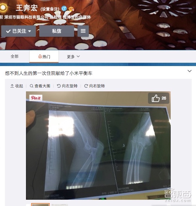 智东西晚报:Sulon联合AMD推VR/AR双用无线头显 小米平衡车摔伤用户惹争议