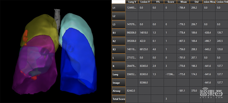 GE医疗推新冠病毒AI平台！解读背后的硬核技术