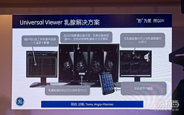通用电气推出智能医疗影像系统UV6.0 已在3000家机构投入使用