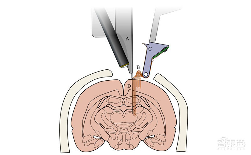 明年开始人体实验!马斯克脑机接口重大突破,已能让猴子用脑控制电脑