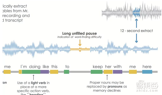 多伦多出现AI创业热 45秒诊断老年痴呆症