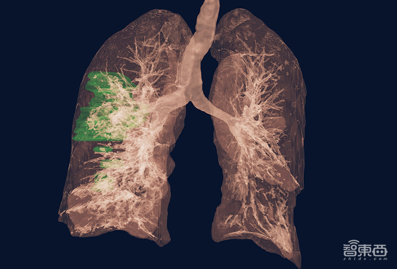 英伟达扔出20枚“AI核弹”！540亿个晶体管的GPU，一个机柜秒数据中心