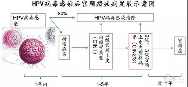 AI造福女性显身手!看华为云的AI防癌黑科技牛在哪