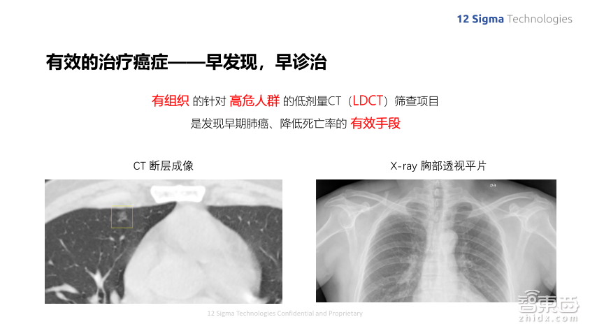 深度学习如何提升肺结节良恶性诊断准确率到90%?图玛深维首席科学家陈韵强给出了答案!