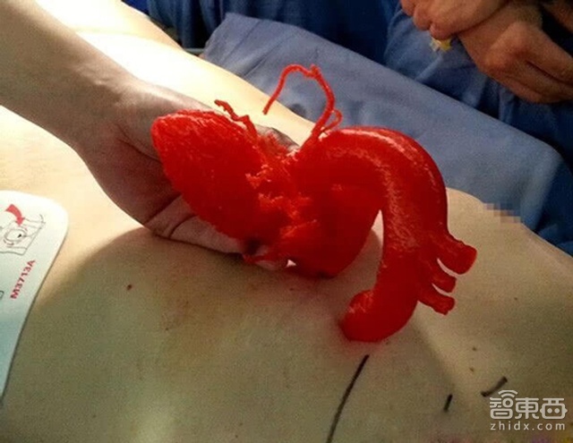 3D打印带来医疗新革命 10年后规模有望超百亿