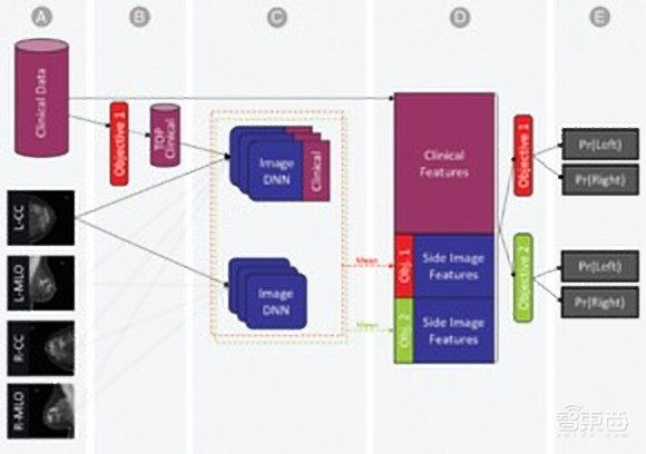 IBM发布最新AI模型!可预测一年内恶性乳腺癌转化概率