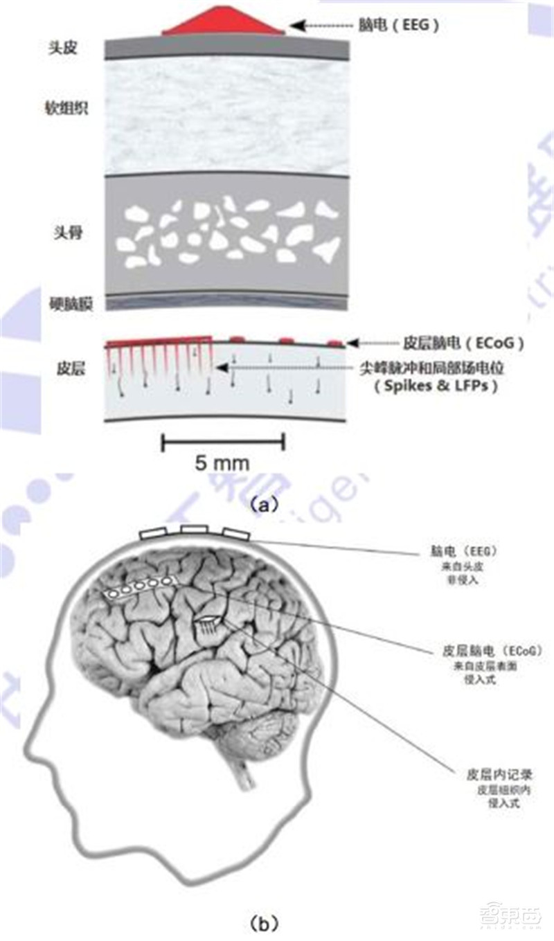 脑机接口破圈医疗！对五种疾病或有奇效，难怪马斯克吹爆 | 智东西内参