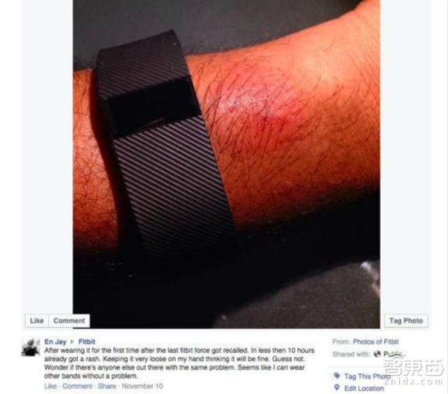 不是材料没选对 Charge 皮肤过敏只因太紧