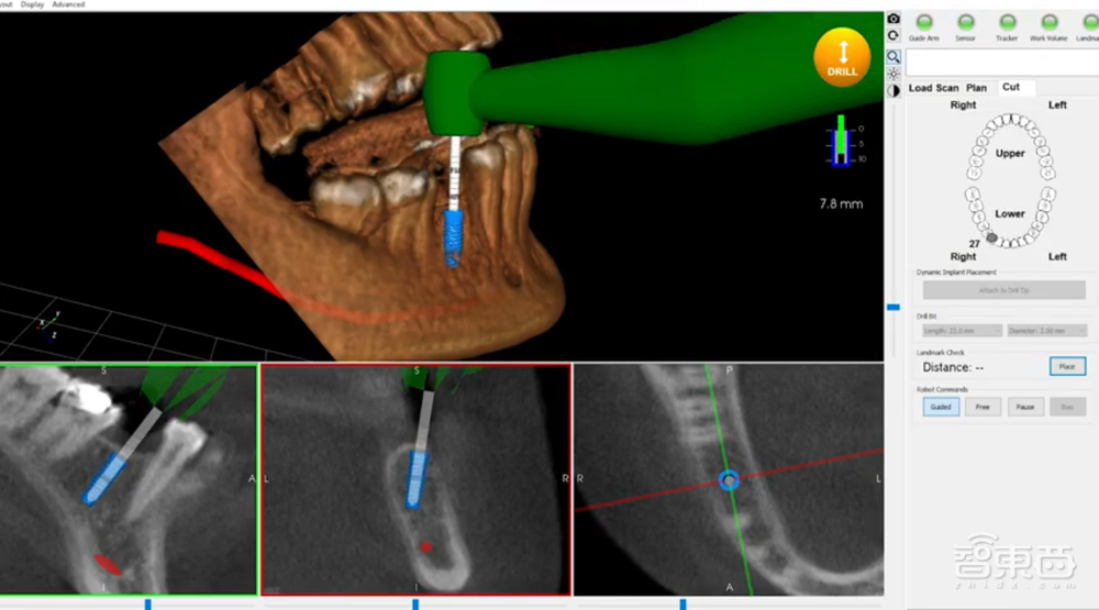 收割上亿美元的牙科手术机器人！获美国FDA许可，解放牙医双手