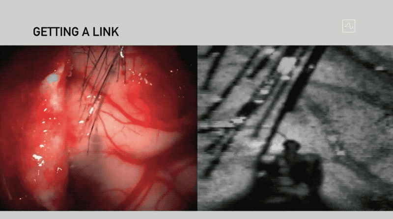 马斯克推脑机接口芯片！1小时安装睡觉时充电，植入活猪现场遛很快人体试验