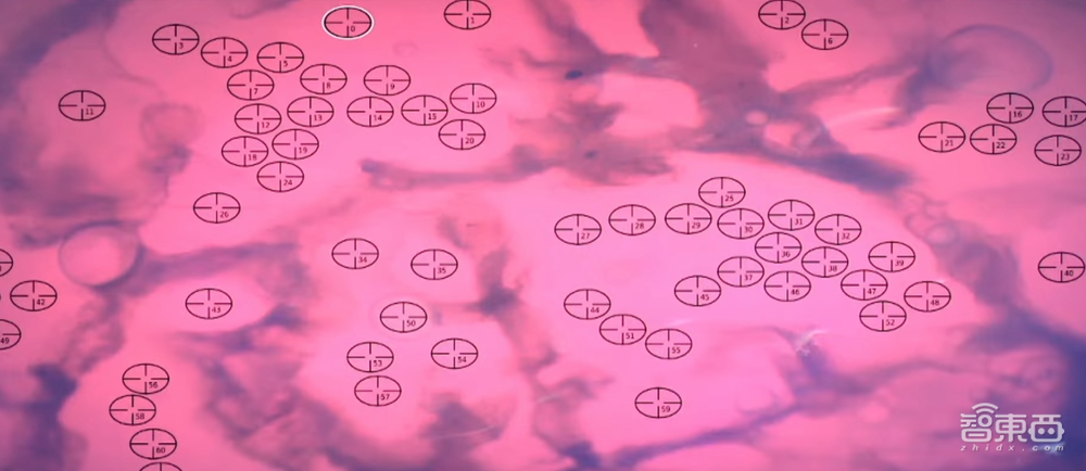 马斯克15分钟给猴脑植入芯片,演示用意念打字