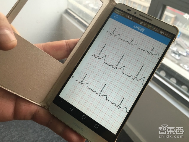 硬创先锋吴伟:自招医生队伍的任性医疗硬件创业者