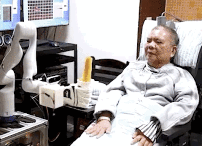 中国首例！大脑植入电极，高位截瘫病人用意念喝水