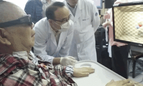 中国首例！大脑植入电极，高位截瘫病人用意念喝水