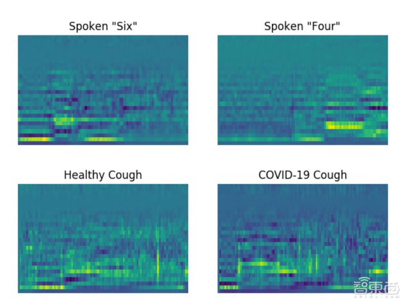 新冠病毒还能用语音识别？AI模型“听”咳嗽声判断是否感染