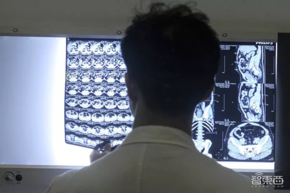 DeepMind发表新作！AI可协助医生作出影像诊断，部分误诊率下降25%